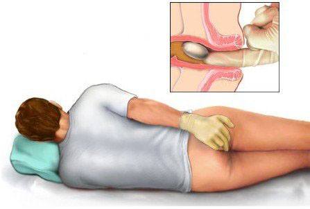 Bị trĩ nội cần chú ý điều gì?