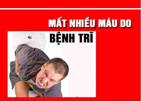 Bị bệnh trĩ có sao không?