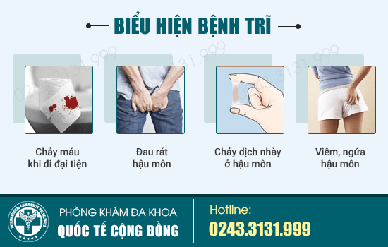 5 Biểu Hiện Bệnh Trĩ Bạn Chớ Coi Thường