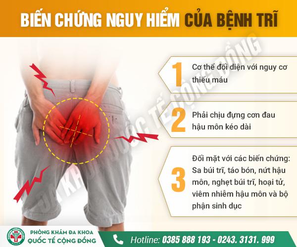 Trĩ có nguy hiểm không? Điều trị trĩ như thế nào hiệu quả?