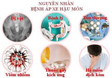 Nguyên nhân gây bệnh apxe hậu môn thường gặp