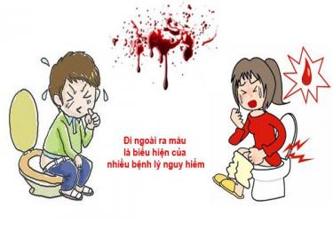 Đi vệ sinh ra máu – dấu hiệu cảnh báo ung thư trực tràng